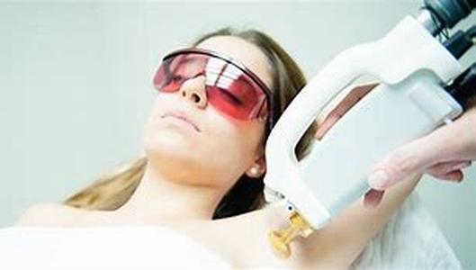 Laser Hair Removal