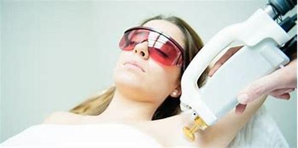 The Benefits Of Professional Laser Hair Removal