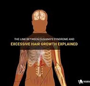 The Trouble With Long Hair - Cushing's Disease