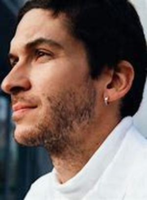 Male Pattern Baldness - Causes, Symptoms Treatment