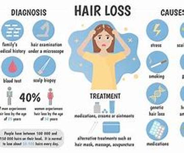The top 3 reasons for losing your hair
