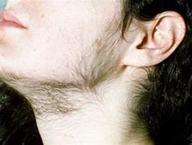 The Truth About Hair Removal