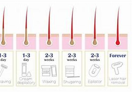 Laser Hair Removal, Why Should You Consider Doing It