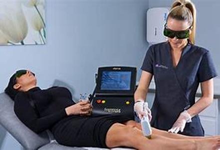 Laser Hair Removal in California
