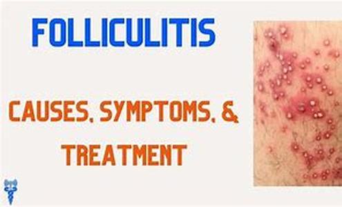 Causes And Treatment For Hair Loss