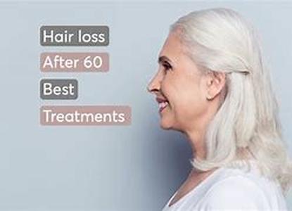Hair Loss Help
