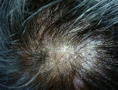 Hair care tips and more