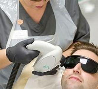Laser Hair Removal - Treatment for Permanent Hair Removal