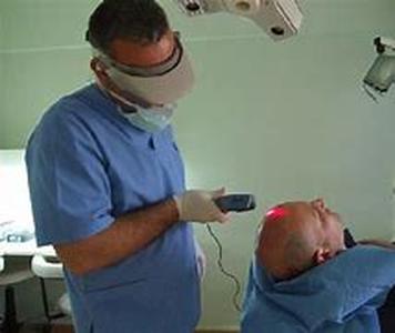 Scope of laser surgery as a hair transplant procedure