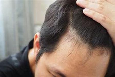 Are hair loss treatments just one big scam
