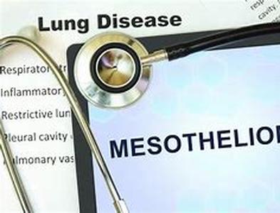 Mesothelioma Treatment