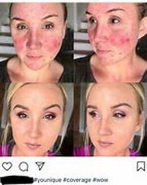 Do Anti Wrinkle Creams actually work