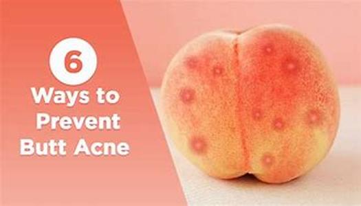 Busting Some Skin Care Myths