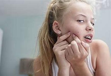 Acne and Adult Acne (Rosacea), what is wrong with me