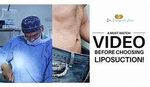 Things To Consider Before Getting Snipped