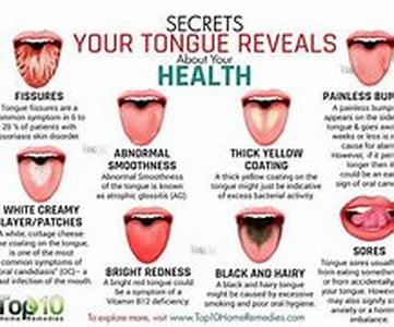 Toenail Fungus- Toenail Fungus Treatments That Work and Those That Dont