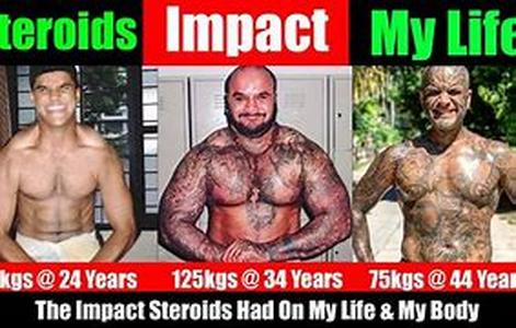 Anabolic Steroids Are Muscle Building Steroids