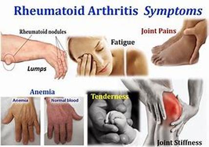Arthritis Pain Relief