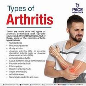 Arthritis Knee Braces
