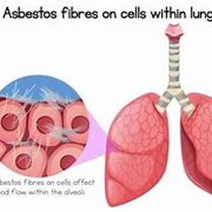 Asbestos Prevention  Asbestos is a type of fibrous mineral known for its fire resistant properties and high tensile strength