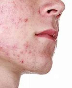 Skin Care Information