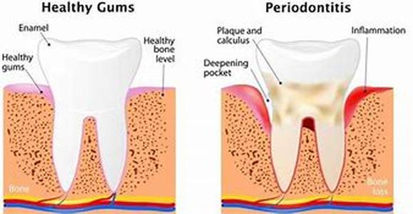 The Culprits: Causes of Snoring