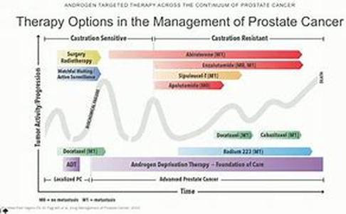 Prostate Cancer Radiation Treatment By Radioactive Seed Implants  Prostate cancer radiation treatment by radioactive seed implants is one approach, while beaming radiation to kill the cancer cells is another