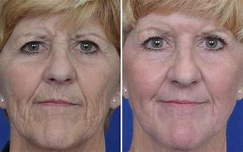 Cosmetic Dentistry Fixes Are Big Business for Dentists