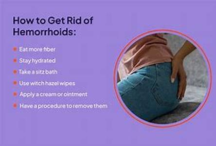 Hemorrhoids Treatment - The Natural Way