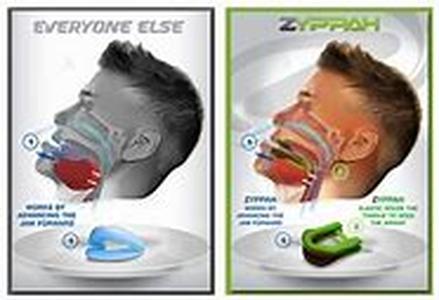 Tinnitus  Causes and Treatment