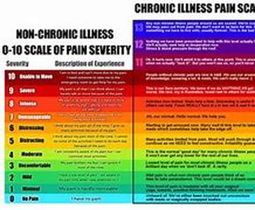 Arthritis Symptoms