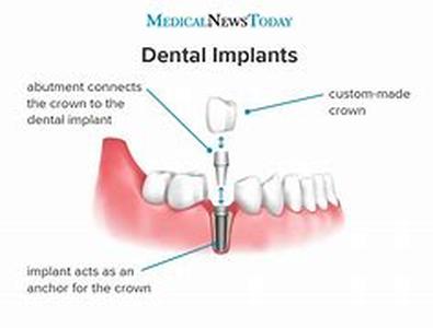 Dental Assistants