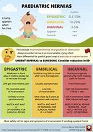 Childhood Strep Throat Overview
