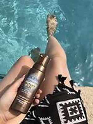 Sunburn Home Remedies