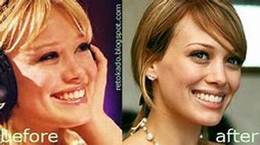 High Cost Cosmetic Dentistry