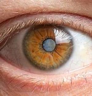 Car Accident Article: Car Accidents  Post Traumatic Stress Disorder