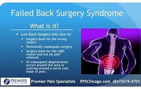 Back Pain Management And Relief