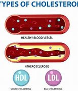 Cholesterol And Diet
