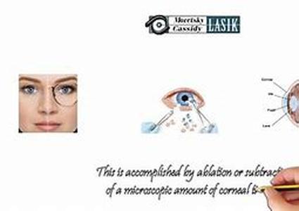 Lasik Replaces Eye Glasses