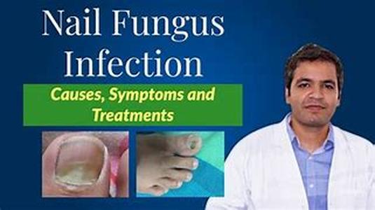 NAILS IN HEALTH AND DISEASE