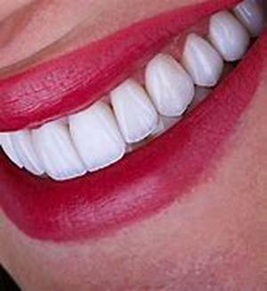 Dental Implants Information
