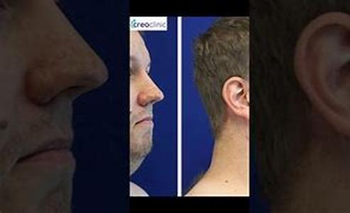 Plastic Surgery And Cosmetic Surgery As Options