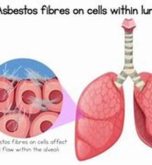 Asbestos Education  Due to the fire- resistant facet of the fibrous mineral, the Romans in the middle ages were deeply fascinated that they applied it as a border to their armors for battle