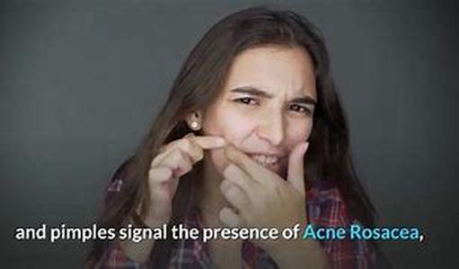 Acne - What Causes Acne