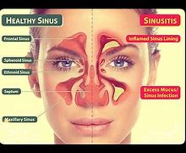 Simple Tips For Safe Tanning