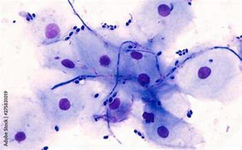 Cancer Survivors Move Beyond The Cure