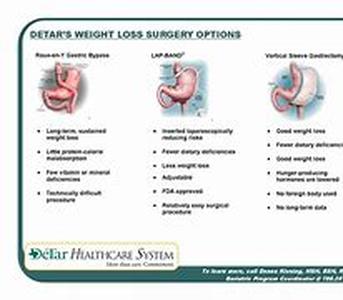 Weight Loss Pills Explained