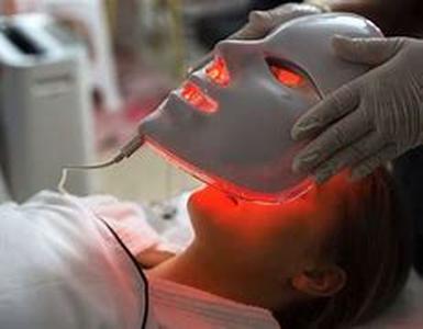 Acne Alternative Treatments