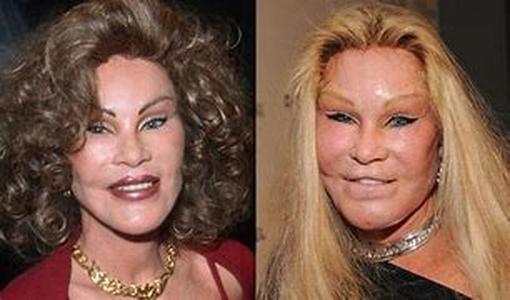 Plastic Surgery Through the Ages