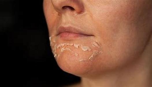 Pediatric Advisor for Bad Breath in Infants  Is your child affected by bad breath